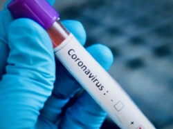 Corona-Virus - Entwicklung des Infektionsgeschehens im Landkreis Northeim: Heute erstmals keine neue bestätigten Corona-Virus Fälle - 24 Personen genesen